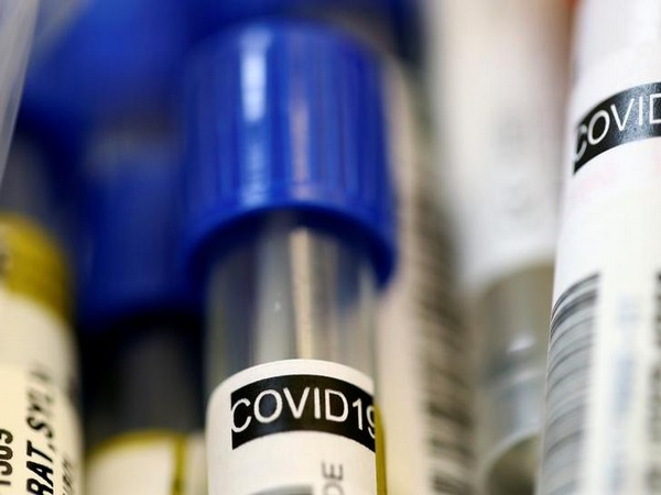 Odisha Coronavirus COVID19 Tests Record